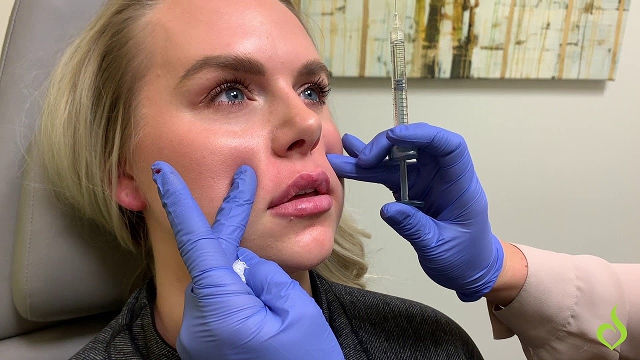 Patient receiving facial filler treatment in clinic.