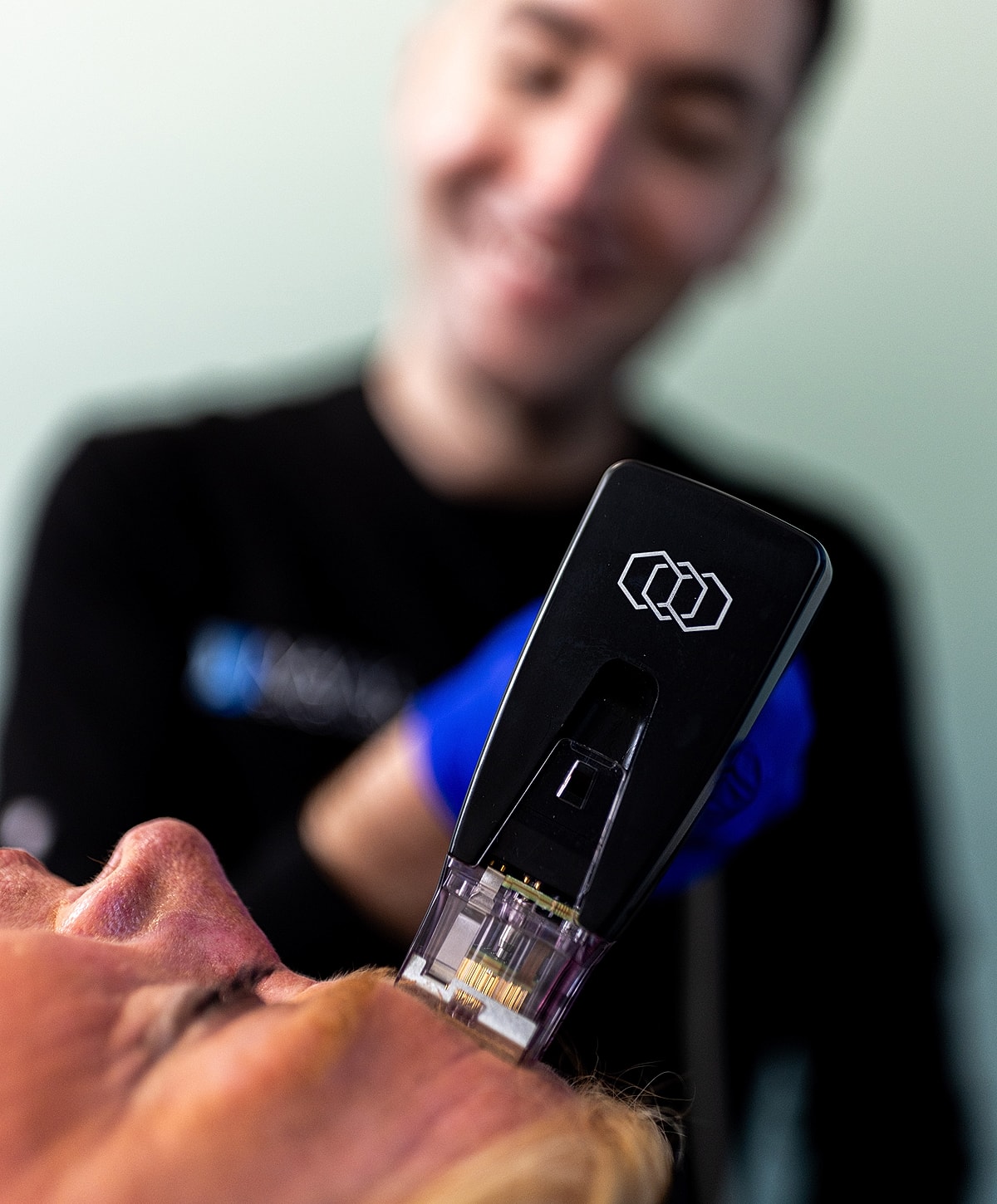 Skincare procedure with a beauty device in use.